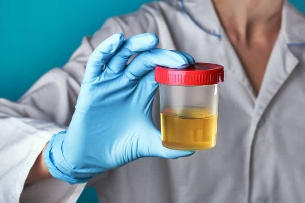 How to sterilize a container for urine sample?